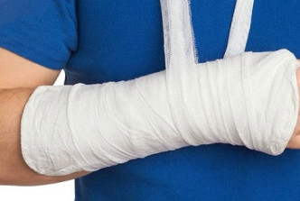 Ngứa ngáy, khó chịu khi bó bột – vấn đề tưởng nhỏ nhưng “ám ảnh” nhiều người
