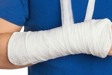 Ngứa ngáy, khó chịu khi bó bột – vấn đề tưởng nhỏ nhưng “ám ảnh” nhiều người