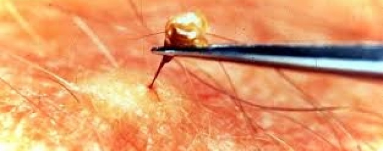 Những điều cần làm khi bị côn trùng cắn