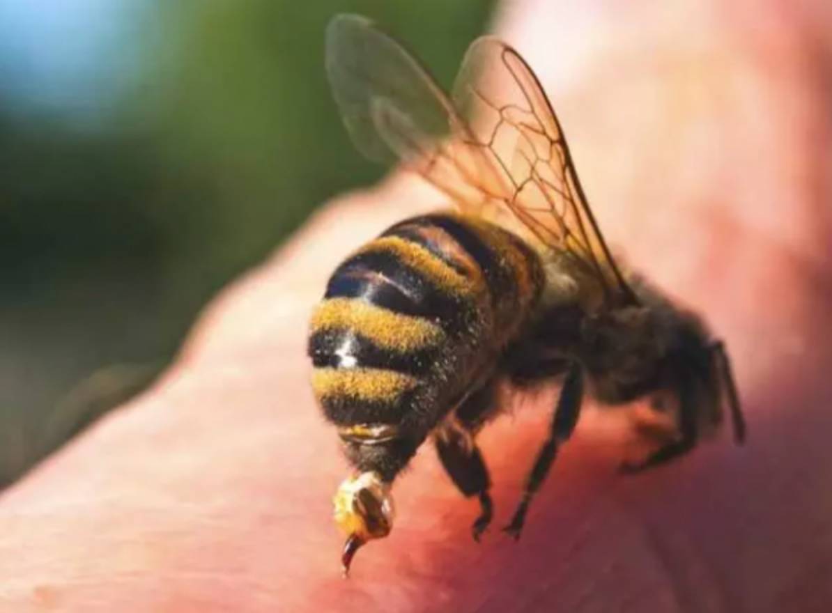 Bị ong vò vẽ đốt nên làm gì Cách sơ cứu khi bị ong vò vẽ đốt